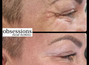 advanced aesthetic practitioner
